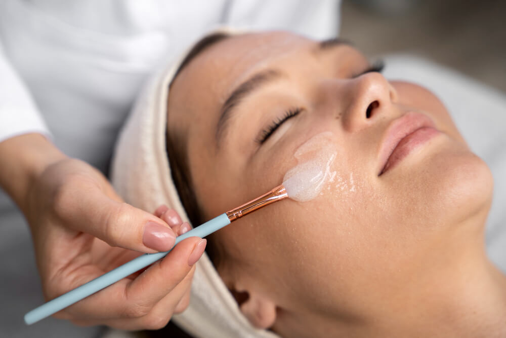 About Chemical Peels